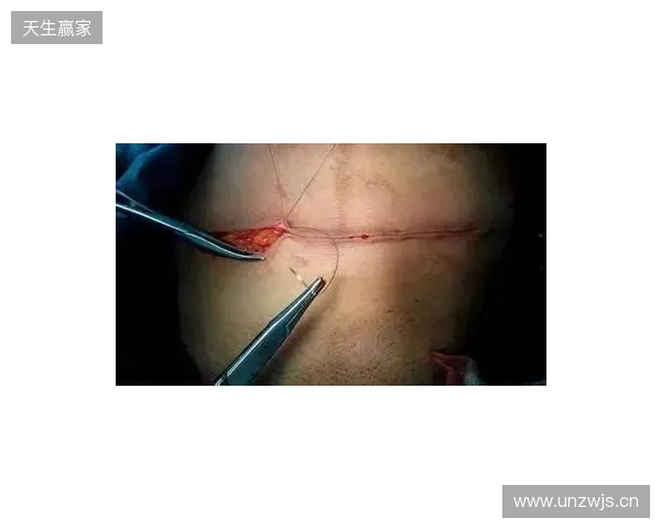 广州豹官方:杨浩眉弓伤口缝合30余针,预计5-7天后拆线